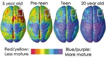 Adolescent Brain Over Time 