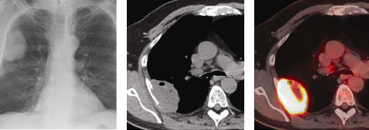 Abdominal Images