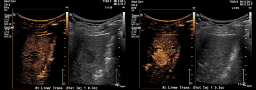 Abdominal imaging