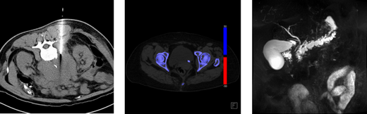 Abdominal Images