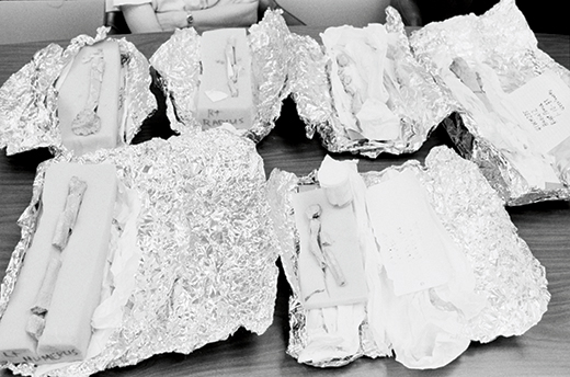 Bone fragments lying on foam padding