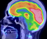 Nuclear Medicine Protocols