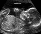 Ultrasound Protocols