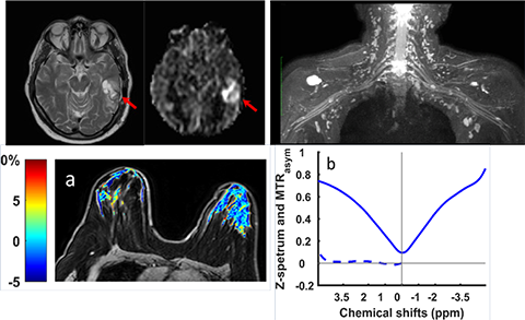 MRI Program