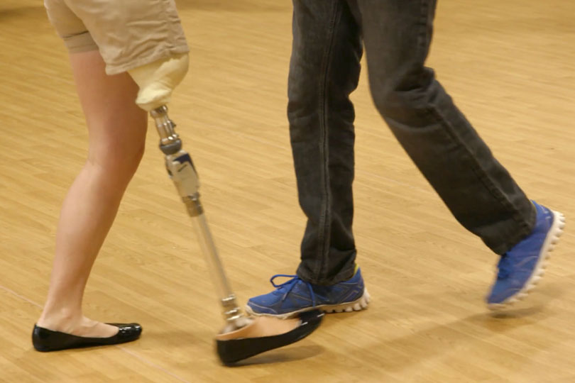 Close-up shot of legs, with a woman with a prosthetic leg and a man dancing