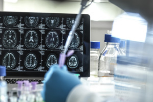 Lab setting with close up of computer screen containing brain scans