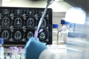 Lab setting with close up of computer screen containing brain scans