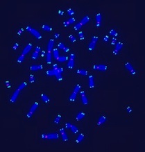 Chromosomes with stained telomeres