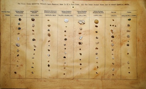 Kidney Stone Chart