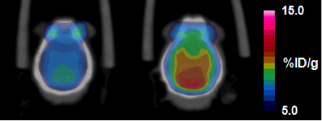 Brain Glucose Metabolism