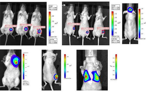 Detection of Breast Tumors using Spectrum or Lumina