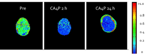 Dynamic Contrast-Enhanced MRI