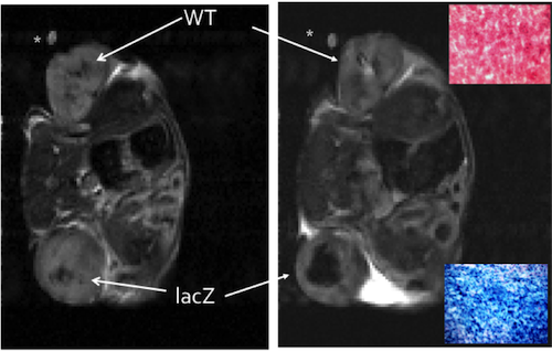 MRI Detection of Enzyme Activity