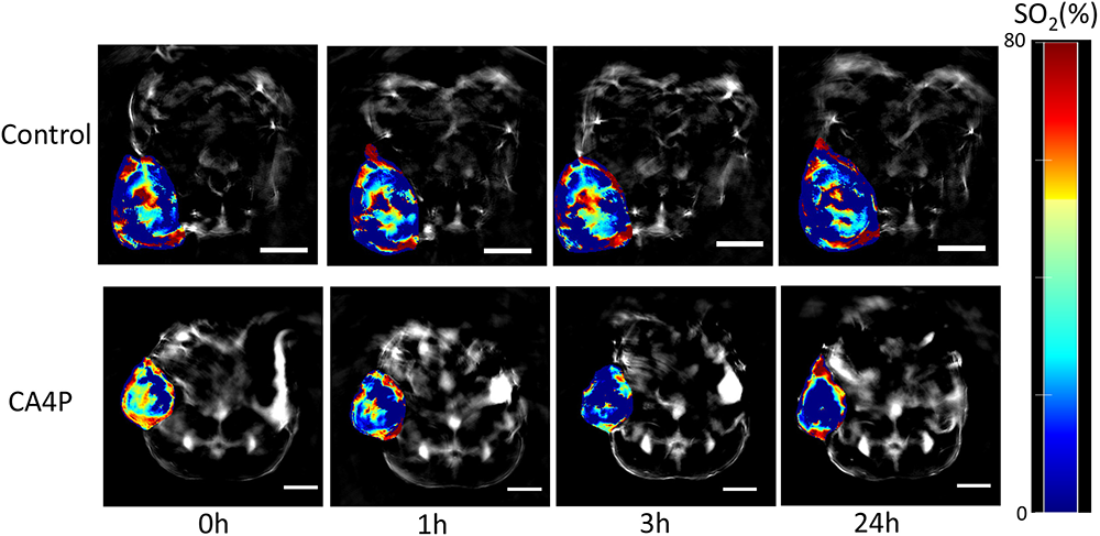 MSOT images of lung xenograft tumor at different time points