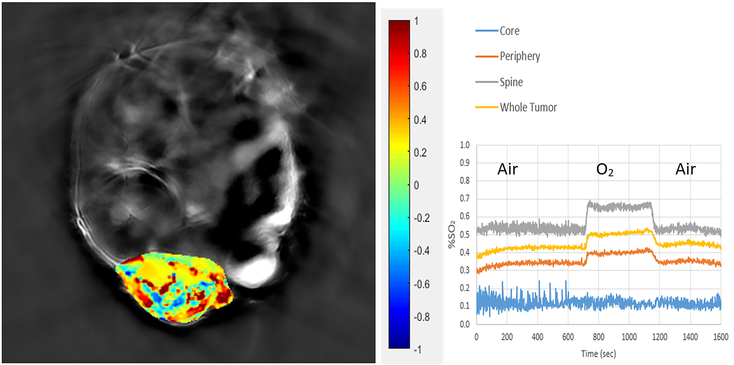 Transaxial image through mouse with MDA-MB-231 tumor in mammary fat pad