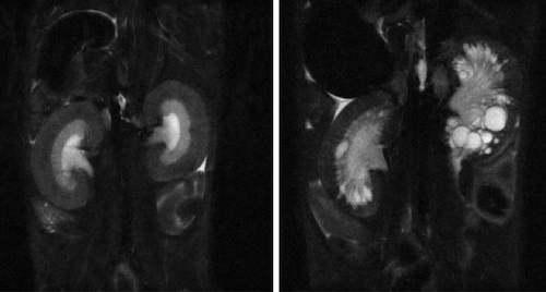 Mouse Kidney Image