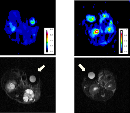 Mouse Kidney PKD Image