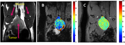 Oxygen Enhanced MRI