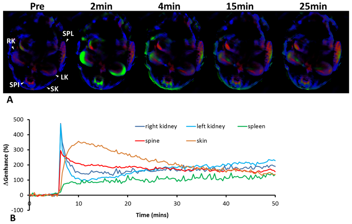 Photoacoustic assessment of healthy nude mouse after injection of a fluorescent blood pool imaging agent