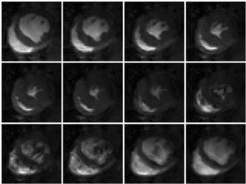 Rat Cardiac Image