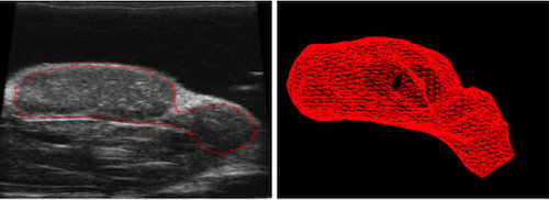 Rat Tumor