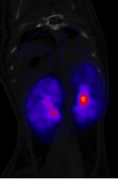 Renal Image