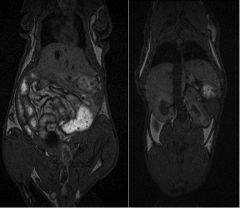 T1 Weighted MRI