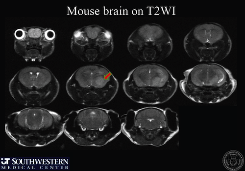 T2WI Mouse Brain Image