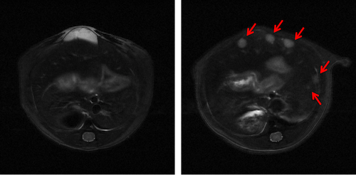 T2WI Longitudinal Images