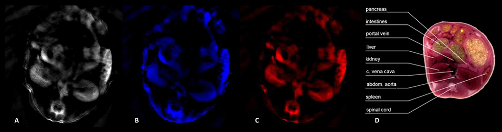 Transaxial cross-sectional PAT images of a nude mouse