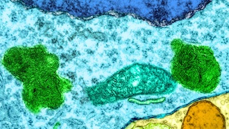 This false-colored cell image shows two green lysosomes containing undigested lipids. A new study shows how the “fingerprint” of these lipids can help scientists determine different types of dementia. The study also identifies a protein in the lysosome that helps break down the lipids – a discovery that may provide a new target for treating dementia.” width=
