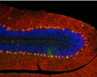 Pictured are cerebellar Purkinje cells, which regulate and coordinate motor movements. The cells were part of a study that showed autism-related social deficits – but not repetitive behaviors – can be corrected in mice even into adulthood.