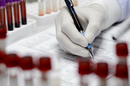 Close-up of a person's gloved hand writing on a chart with an ink pen