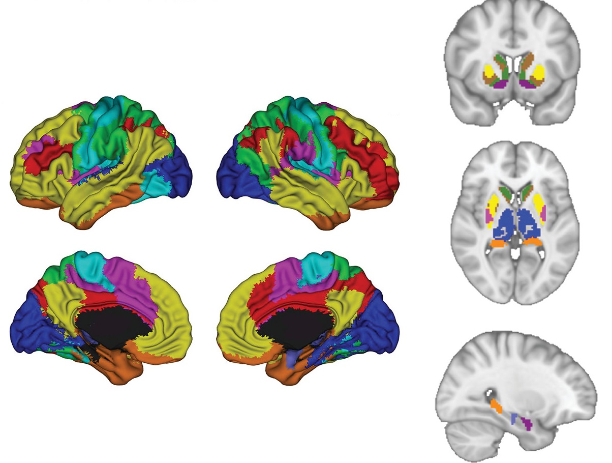 Scientists used artificial intelligence to examine neural activity throughout the brain while study participants processed emotions.