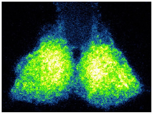 yellow, blue, and green clock genes