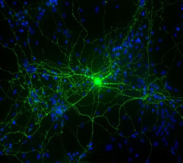 normal neuron