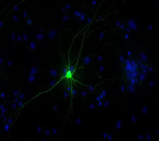 neuron with a mutated UBE3B gene