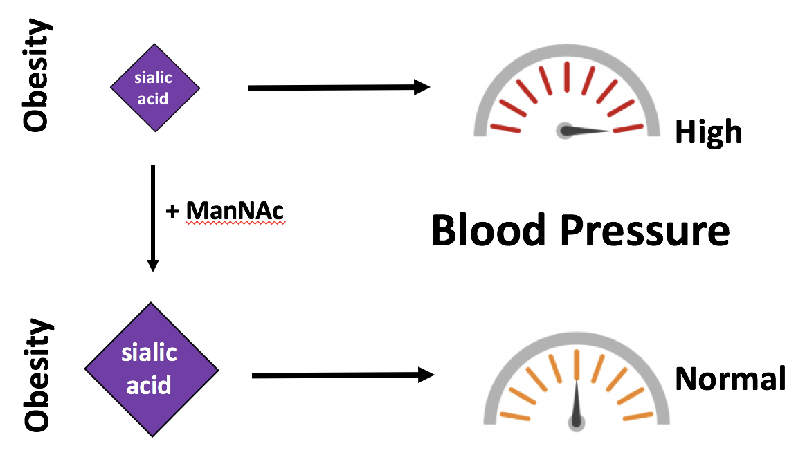 A UTSW study showed that loss of the sugar molecule sialic acid leads to high blood pressure in those who are obese. In obese mice, adding a compound called ManNac restored sialic acid levels and dropped blood pressure back to normal. Researchers are now hoping to test the compound’s effectiveness in people to prevent hypertension.