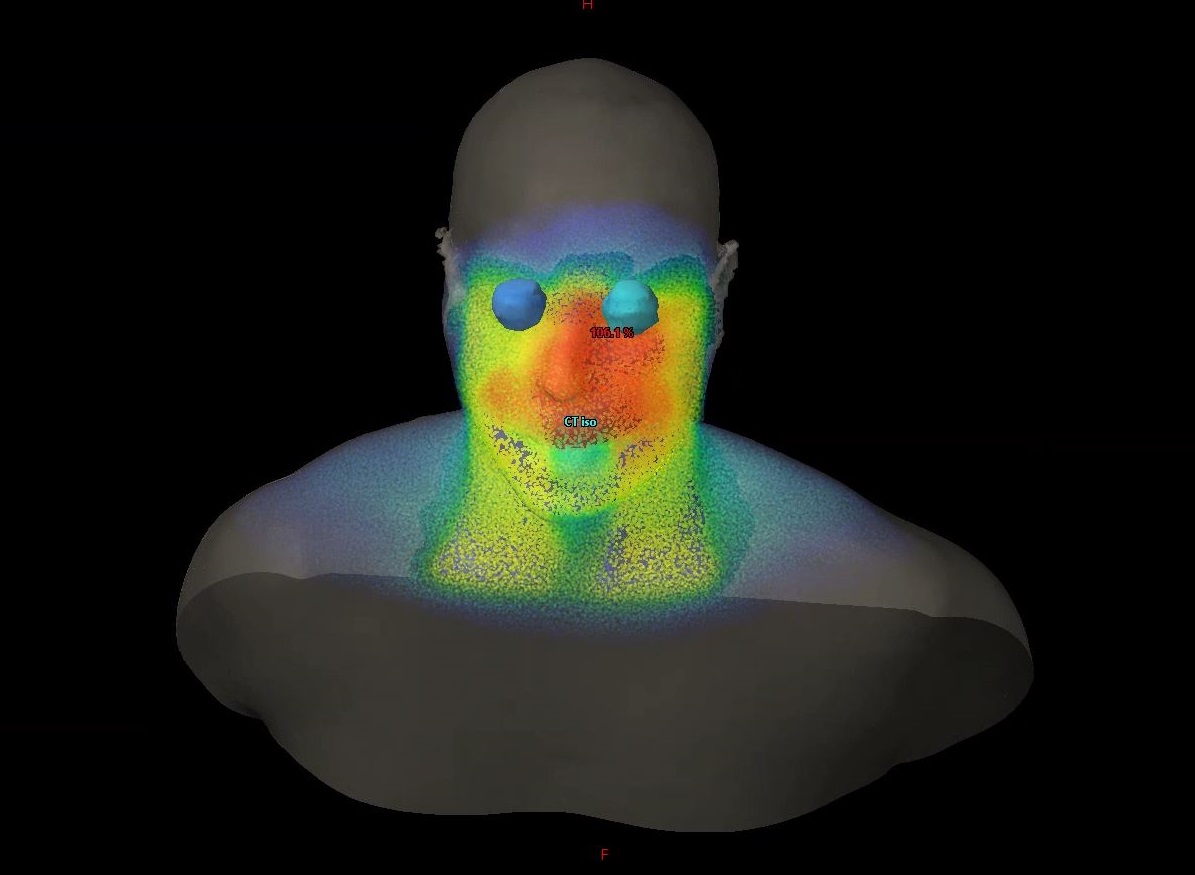 A yellow, red, and green image of a person's head