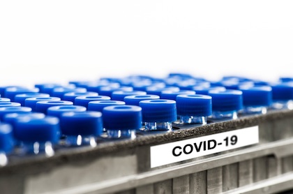 Rack of vials with blue caps and labeled COVID-19
