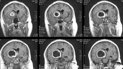 Composite image of six brain scans