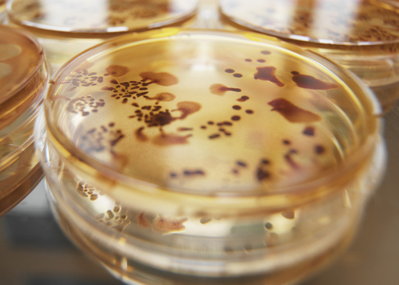 Campylobacter jejuni in petri dishes