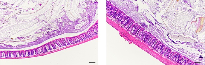 Stained colon sections from mice