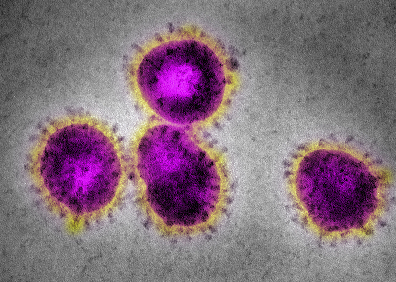 Miroscopic image of the coronavirus