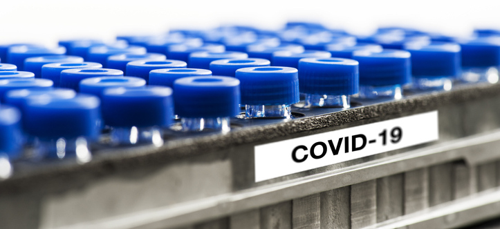 Test tubes in metal rack with COVID-19 samples