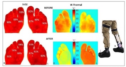 Heat maps of feet
