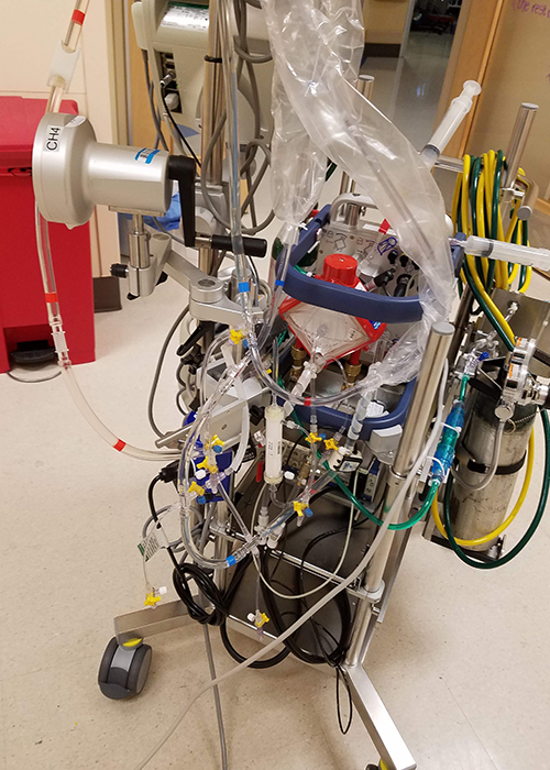 ECMO machine