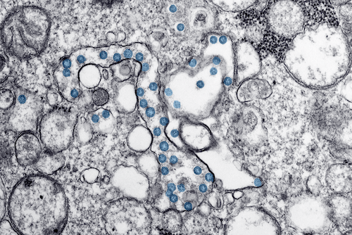 Transmission electron microscopic image of an isolate from the first U.S. case of COVID-19