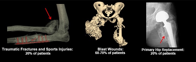 Composite image of traumatic sports injuries, blast wounds, and hip replacements