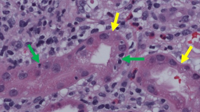 Microscopic image of a kidney biopsy